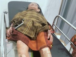 Mak Okoy, Lansia Sebatang Kara, Alami Luka Bakar di Sekujur Tubuh Akibat Kebakaran Rumah