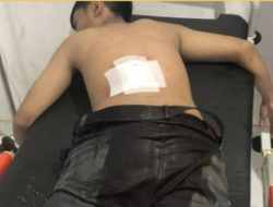 Perang Sarung Kebablasan, Remaja Alami Luka Parah Akibat Tebasan Golok