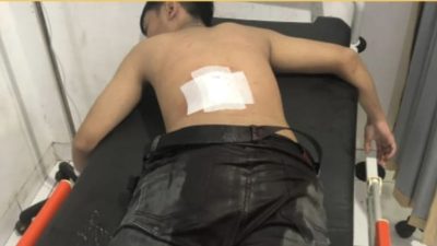 Perang Sarung Kebablasan, Remaja Alami Luka Parah Akibat Tebasan Golok