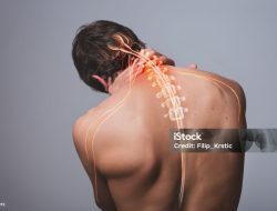 Mengenal Lebih Dekat Penyebab Saraf Kejepit dan Cara Pencegahannya