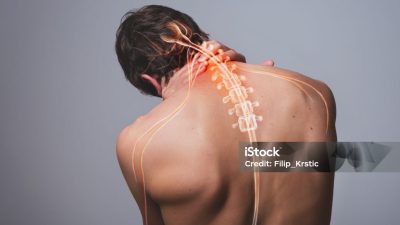 Mengenal Lebih Dekat Penyebab Saraf Kejepit dan Cara Pencegahannya
