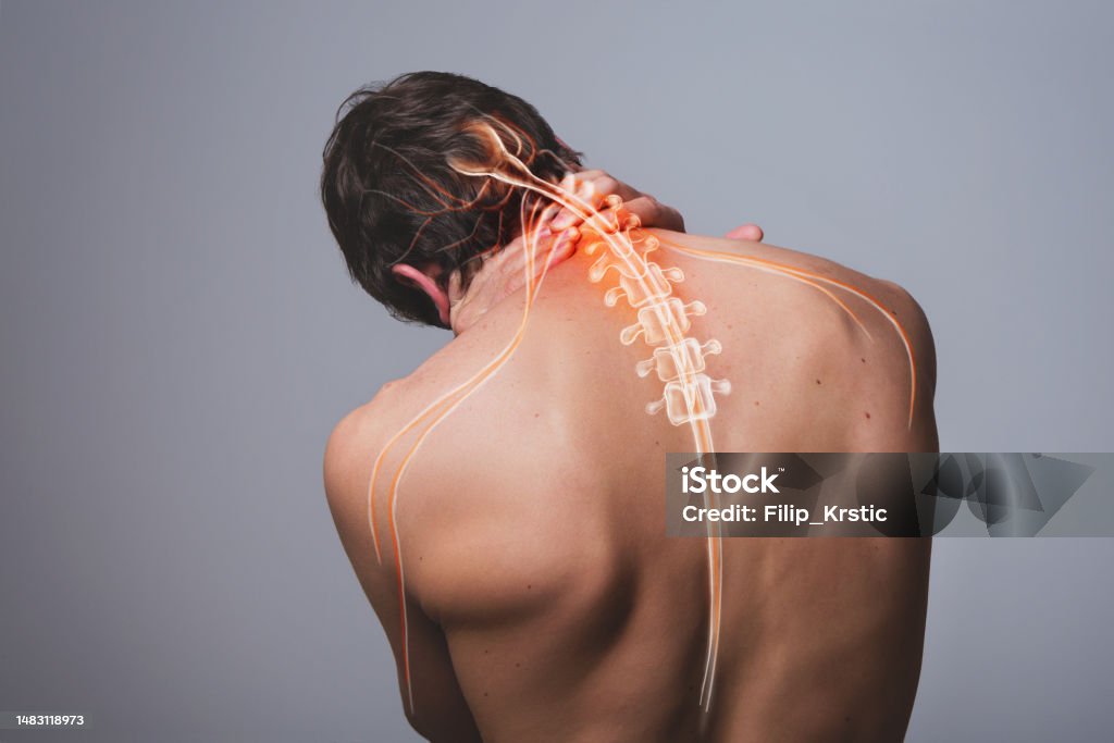 Mengenal Lebih Dekat Penyebab Saraf Kejepit dan Cara Pencegahannya