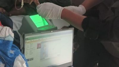 Penyakit Kulit Langka Derita Warga Sukabumi, Baru Terungkap Setelah Viral di Medsos