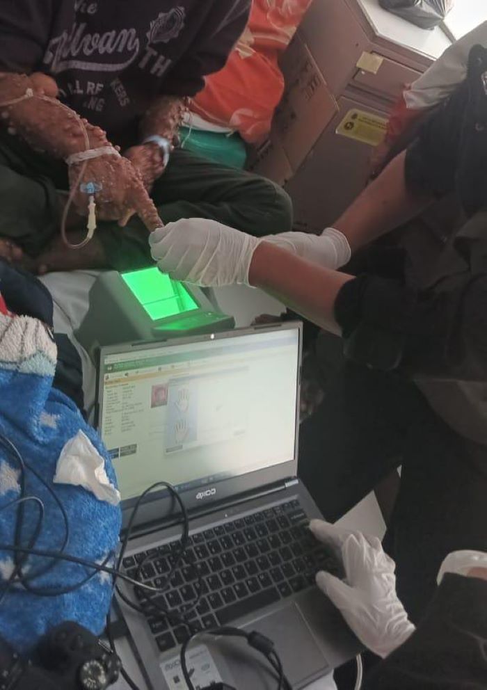 Penyakit Kulit Langka Derita Warga Sukabumi, Baru Terungkap Setelah Viral di Medsos
