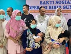 RSUD R. Syamsudin, SH Bantu 16 Pasien Lewat Operasi Bibir Sumbing Gratis