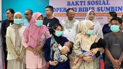 RSUD R. Syamsudin, SH Bantu 16 Pasien Lewat Operasi Bibir Sumbing Gratis