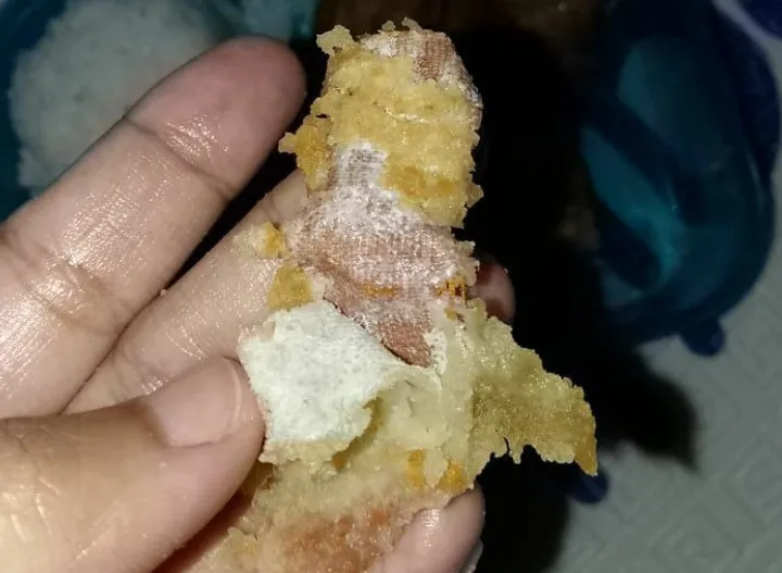 Program Makan Bergizi Gratis di Sukabumi Dikejutkan Temuan Plester Luka dalam Menu