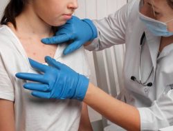 Puskesmas Sukabumi dan Karangtengah Siaga, Kasus Suspek Campak Tembus 44 Orang